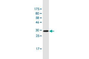 Western Blot detection against Immunogen (31. (FZD2 anticorps  (AA 192-245))