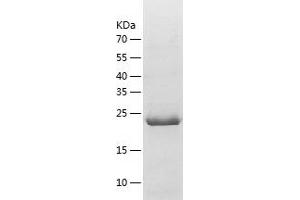 Western Blotting (WB) image for Adhesion Molecule, Interacts with CXADR Antigen 1 (AMICA1) (AA 6-235) protein (His-IF2DI Tag) (ABIN7121723)