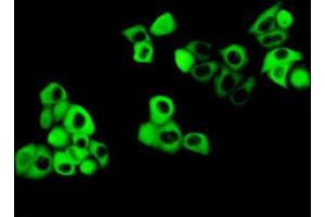 Figure:FITC staining on IHC-P Simple: Mcf7 cells