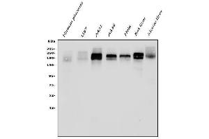 Western blot analysis of EGFR using anti-EGFR antibody (ABIN7601478).