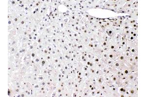 HMGB1 was detected in paraffin-embedded sections of mouse liver tissues using rabbit anti- HMGB1 Antigen Affinity purified polyclonal antibody (Catalog # ) at 1 µg/mL.