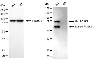 Western blotting analysis using PCSK9 antibody (ABIN7799926).