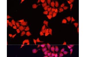 Immunofluorescence analysis of HeLa cells using FXR1 Polyclonal Antibody at dilution of 1:100.