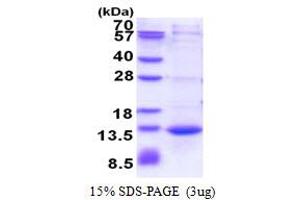 SDS-PAGE (SDS) image for Calcium/calmodulin-Dependent Protein Kinase II Inhibitor 1 (CAMK2N1) (AA 1-78) protein (His tag) (ABIN5853555)