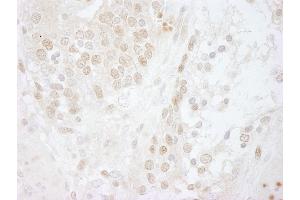Immunohistochemistry (IHC) image for anti-COP9 Constitutive Photomorphogenic Homolog Subunit 5 (Arabidopsis) (COPS5) (AA 175-225) antibody (ABIN7448494)
