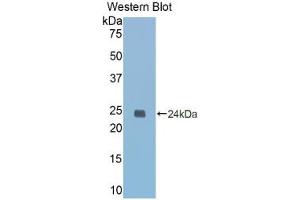 Western blot analysis of the recombinant protein. (Caspase 1 anticorps  (AA 119-296))