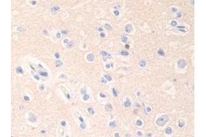 DAB staining on IHC-P; Samples: Human Cerebrum Tissue (Epsin 1 anticorps  (AA 279-437))