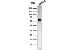 Western Blot Analysis of Ramos cell lysate using CD86 Rabbit Recombinant Monoclonal Antibody (C86/2160R).