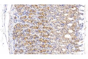 Detection of TNC in Rat Stomach Tissue using Polyclonal Antibody to Tenascin C (TNC)