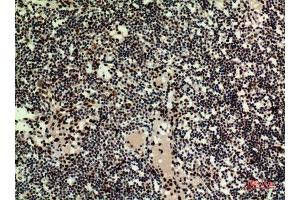 Immunohistochemistry (IHC) analysis of paraffin-embedded Human Lymph Nodes, antibody was diluted at 1:100. (HDGFRP3 anticorps  (Internal Region))