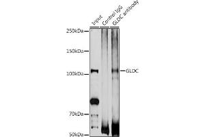 Immunoprecipitation analysis of 200 μg extracts of DU145 cells using 3 μg GLDC antibody (ABIN6132011, ABIN6141119, ABIN6141120 and ABIN6225260). (GLDC anticorps  (AA 36-290))