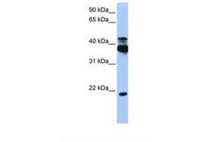 Image no. 1 for anti-serine/threonine Kinase 38 (STK38) (AA 368-417) antibody (ABIN6738495) (STK38 anticorps  (AA 368-417))