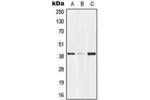 Western blot analysis of GPR174 expression in Jurkat (A), mouse kidney (B), rat kidney (C) whole cell lysates. (GPR174 anticorps  (Center))