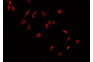 ABIN6266508 staining A549  cells by IF/ICC.
