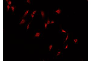 ABIN6266508 staining A549  cells by IF/ICC. (Claudin 2 anticorps  (C-Term))