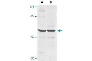 Western blot analysis of CARD9 expression in human MDA-MB-361 (A) and PC-3 (B) cell lysate with CARD9 polyclonal antibody  at 2. (CARD9 anticorps  (AA 521-536))