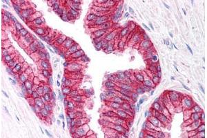 Human Prostate (formalin-fixed, paraffin-embedded) stained with ABCC4 antibody ABIN296628 at 2. (ABCC4 anticorps  (AA 1312-1325))