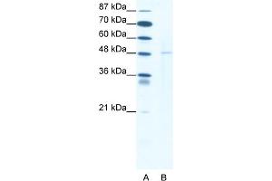 WB Suggested Anti-DEK Antibody Titration:  1. (DEK anticorps  (N-Term))