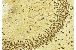 ABIN6268842 at 1/100 staining Mouse brain tissue by IHC-P.