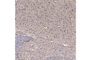 IHC analysis of NOB1 using anti-NOB1 antibody (ABIN7599344). (NOB1 anticorps  (AA 1-389))