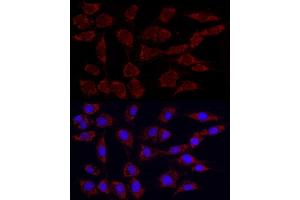 Immunofluorescence analysis of NIH/3T3 using Phospho-PDH-S293 Rabbit mAb (ABIN7269768) at dilution of 1:100 (40x lens).