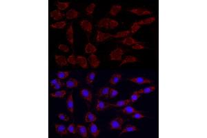 Immunofluorescence analysis of NIH/3T3 using Phospho-PDH-S293 Rabbit mAb (ABIN7269768) at dilution of 1:100 (40x lens). (PDHA1 anticorps  (pSer293))