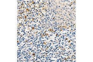 Immunohistochemistry of paraffin embedded human tonsil using CSF1 (ABIN7073553) at dilution of 1:900 (400x lens)