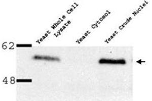Western blot of Nup53p polyclonal antibody  on yeast preparation. (NUP35 anticorps)
