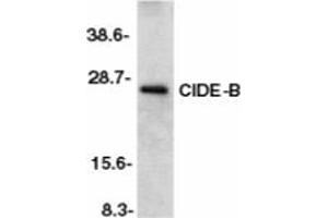 Image no. 1 for anti-Cell Death-Inducing DFFA-Like Effector B (CIDEB) (AA 204-219) antibody (ABIN201953) (CIDEB anticorps  (AA 204-219))