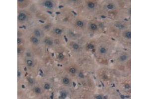 IHC-P analysis of Human Tissue, with DAB staining. (SERPINA3 anticorps  (AA 235-394))