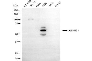 anti-Aldehyde Dehydrogenase 3 Family, Member B1 (ALDH3B1) antibody