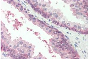 Human Prostate: Formalin-Fixed, Paraffin-Embedded (FFPE)