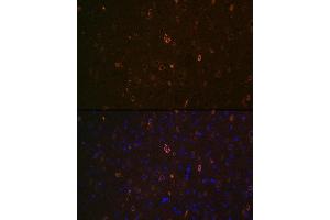 Immunofluorescence analysis of mouse brain using  Rabbit pAb (ABIN7265728) at dilution of 1:100 (40x lens). (ABCA2 anticorps  (AA 2307-2466))
