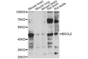 Western blot analysis of extracts of various cell lines, using BSCL2 antibody (ABIN6293870) at 1:1000 dilution.