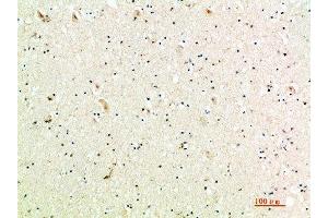 Immunohistochemical analysis of paraffin-embedded human-brain, antibody was diluted at 1:200