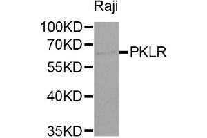 Western Blotting (WB) image for anti-Pyruvate Kinase, Liver and RBC (PKLR) antibody (ABIN1874148) (PKLR anticorps)