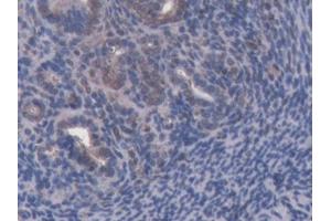 DAB staining on IHC-P; Samples: Mouse Uterus Tissue