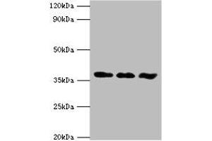 Western blot All lanes: ACVR1 antibody at 6 μg/mL Lane 1: A549 whole cell lysate Lane 2: HepG2 whole cell lysate Lane 3: Mouse gonad tissue Secondary Goat polyclonal to rabbit IgG at 1/10000 dilution Predicted band size: 39 kDa Observed band size: 39 kDa
