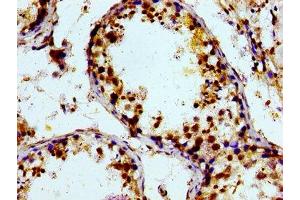 Immunohistochemistry of paraffin-embedded human testis tissue using ABIN7164870 at dilution of 1:100 (PTGR2 anticorps  (AA 206-282))