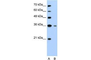 WB Suggested Anti-GZMH Antibody Titration:  2. (GZMH anticorps  (N-Term))