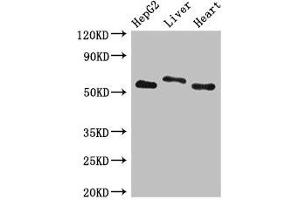Western Blot Positive WB detected in: HepG2 whole cell lysate, Rat liver tissue, Mouse heart tissue All lanes: SLC13A5 antibody at 2. (SLC13A5 anticorps  (AA 156-204))
