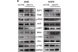 ELF3 can be induced by IL1B and promotes tumor growth through PI3K/AKT/NF-κB pathway. (ELF3 anticorps  (AA 1-280))