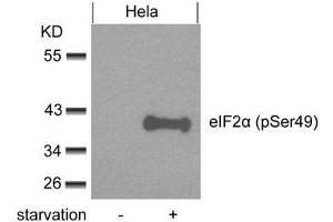 Western blot analysis of extracts from Hela cells untreated or treated with starvation using eIF2a(phospho-Ser49) Antibody. (EIF2S1 anticorps  (pSer49))