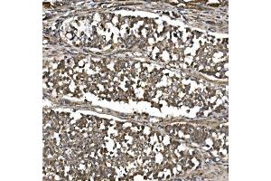 IHC analysis of MitoNEET/CISD1 using anti-MitoNEET/CISD1 antibody (ABIN7601089).