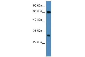 KBTBD8 antibody (70R-10021) used at 0. (KBTBD8 anticorps  (N-Term))