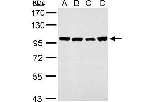 WB Image CSE1L antibody detects CSE1L protein by western blot analysis.