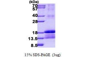 Image no. 1 for Inhibitor of DNA Binding 2 (Id2) protein (His tag) (ABIN1098783)