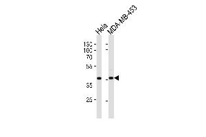 Western blot analysis of lysates from Hela, MDA-MB-453 cell line (from left to right), using Calponin-1 Antibody (N-term) (ABIN390766 and ABIN2841024).