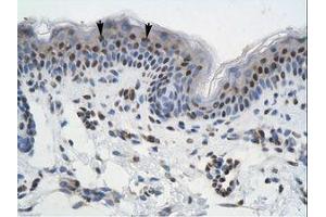 anti-General Transcription Factor III (GTF2I) (AA 208-257) antibody