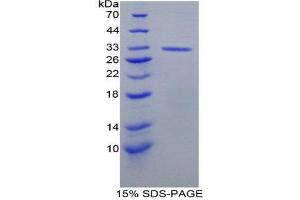 SDS-PAGE (SDS) image for DNA Topoisomerase II (TOP2) (AA 1079-1328) protein (His tag) (ABIN1879696)